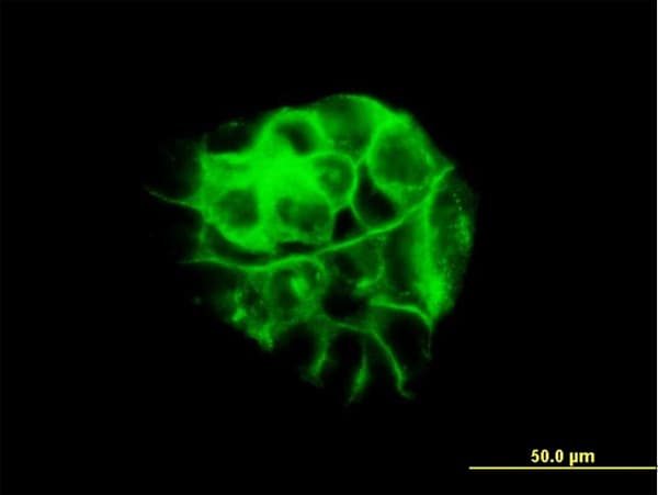 IHC-plus™ Monoclonal Mouse anti-Human JUP/CTNNG/Junction Plakoglobin Antibody (clone 2G9, IHC, IF, WB)
