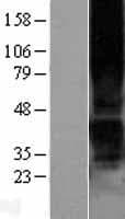 P2RY1 / P2Y1 Protein (Over-Expression Lysate Myc-DDK (Flag))