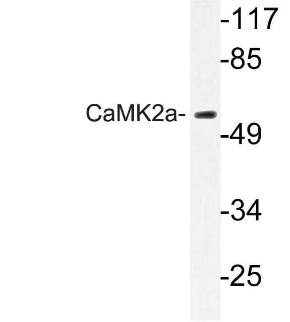 CAMK2A / CaMKII Alpha Antibody (Lys292)