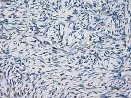 MAP2K1 / MKK1 / MEK1 Antibody (clone OTI1F5)