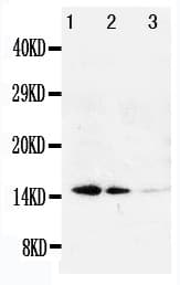 Polyclonal Rabbit anti-Human LGALS1 / Galectin 1 Antibody (aa119-135, IHC, WB)