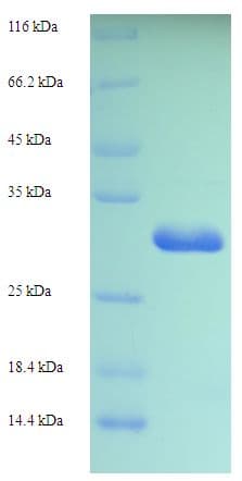 Rat AIF1 / IBA1 Protein (Recombinant His-SUMO)