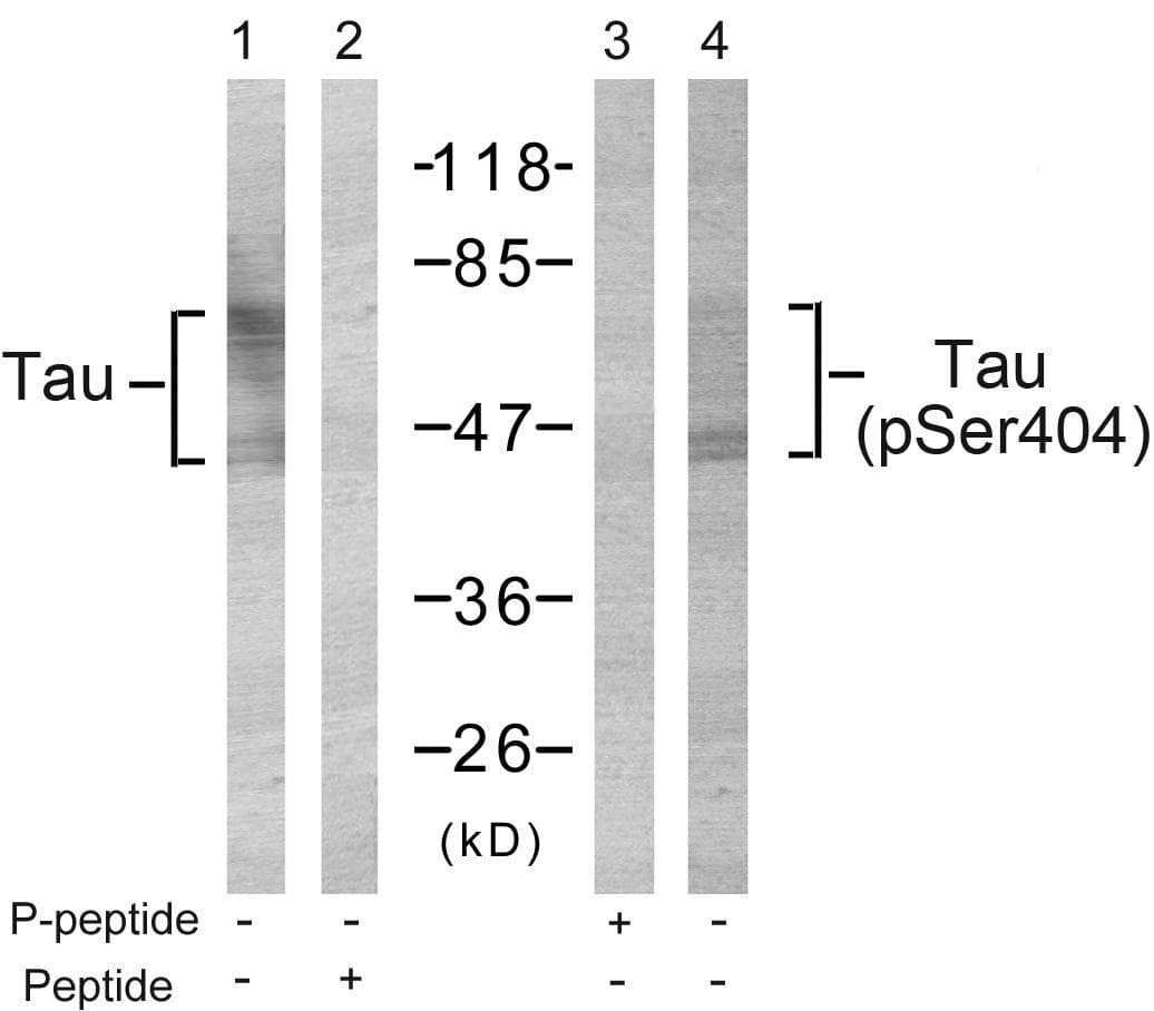 MAPT / Tau Antibody (phospho-Ser404)