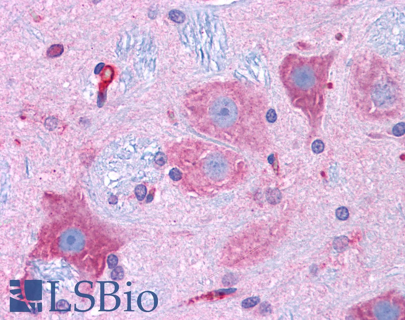 IHC-plus™ Monoclonal Mouse anti-Rat CACNA1D / Cav1.3 Antibody (clone S48A-9, aa859-875, IHC, IF, WB)