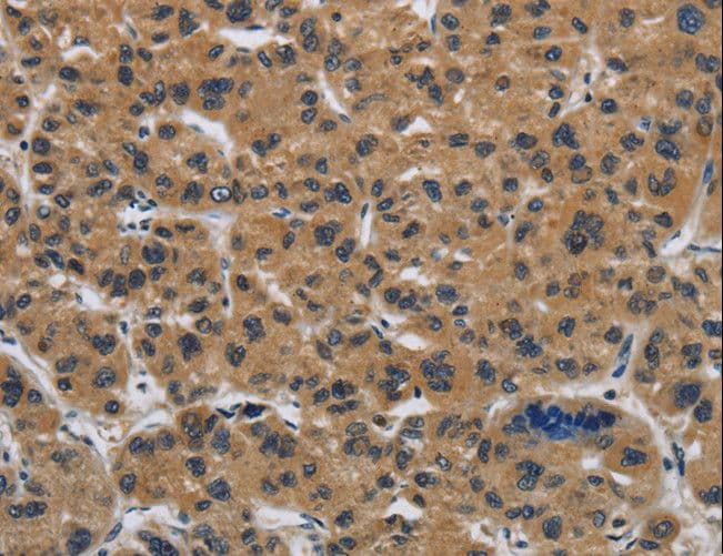 CLDN2 / Claudin 2 Antibody