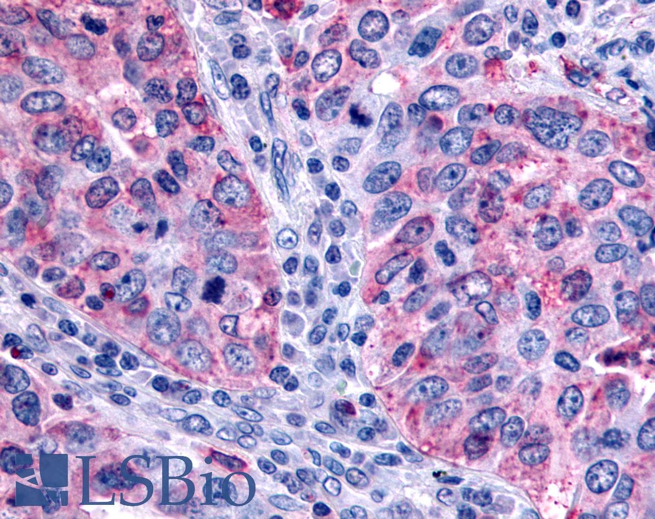 PathPlus™ FFAR2 / GPR43 Antibody (Extracellular Domain)