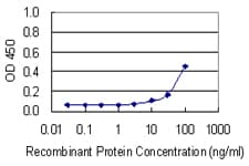Monoclonal Mouse anti-Human BRF1 Antibody (clone 2E9, WB)