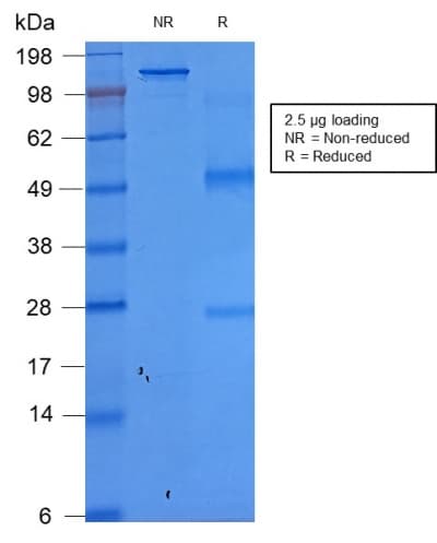Recombinant Monoclonal Mouse anti-Human EPCAM Antibody (clone rEGP40/1372, aa77-202, IHC, WB)