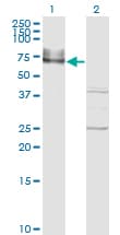 ICAM-1 / CD54 Antibody (clone 3H8-2G6)