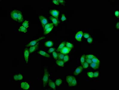 Polyclonal Rabbit anti-Human NAA38 / LSMD1 Antibody