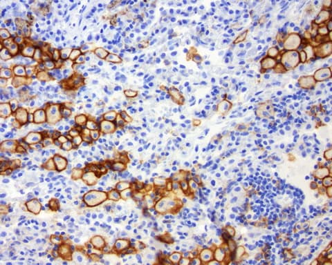 CD274 / B7-H1 / PD-L1 Antibody (C-Terminus, clone OR-5E3)