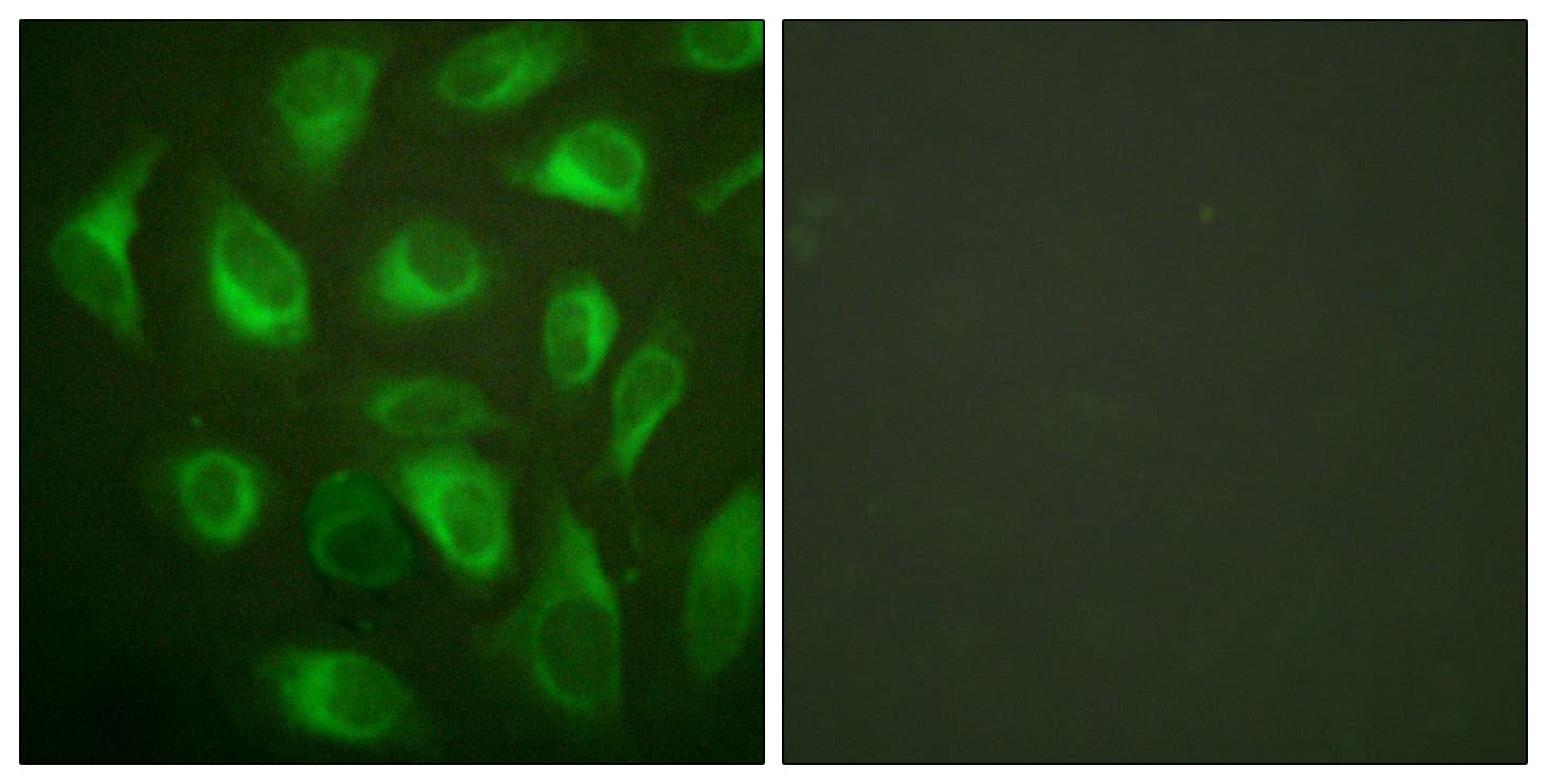 PathPlus™ CANX / Calnexin Antibody (aa543-592)