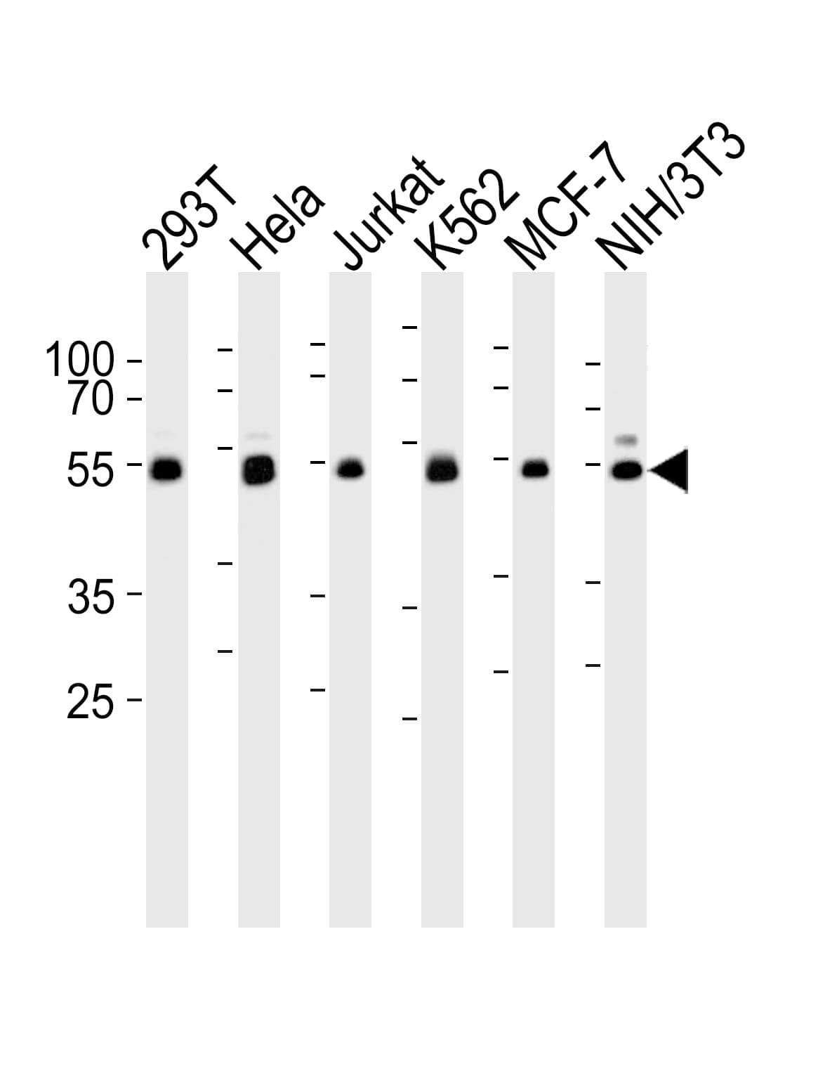 IHC-plus™ NEK2 Antibody (aa396-426)