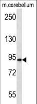 Polyclonal Rabbit anti-Human APBA2 Antibody (aa307-336, WB)