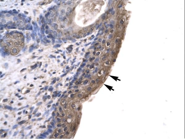 RLIM / RNF12 Antibody (aa532-581)