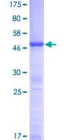 Human NOP16 Protein (Recombinant GST)