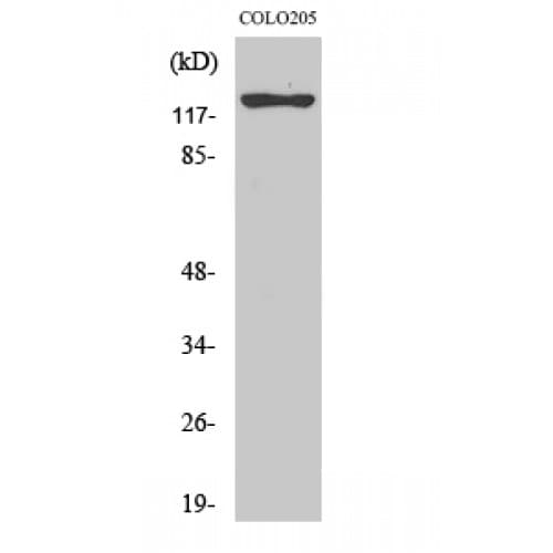 Polyclonal Rabbit anti-Human HTS1 / ST5 Antibody (380-460 aa, Internal, WB)