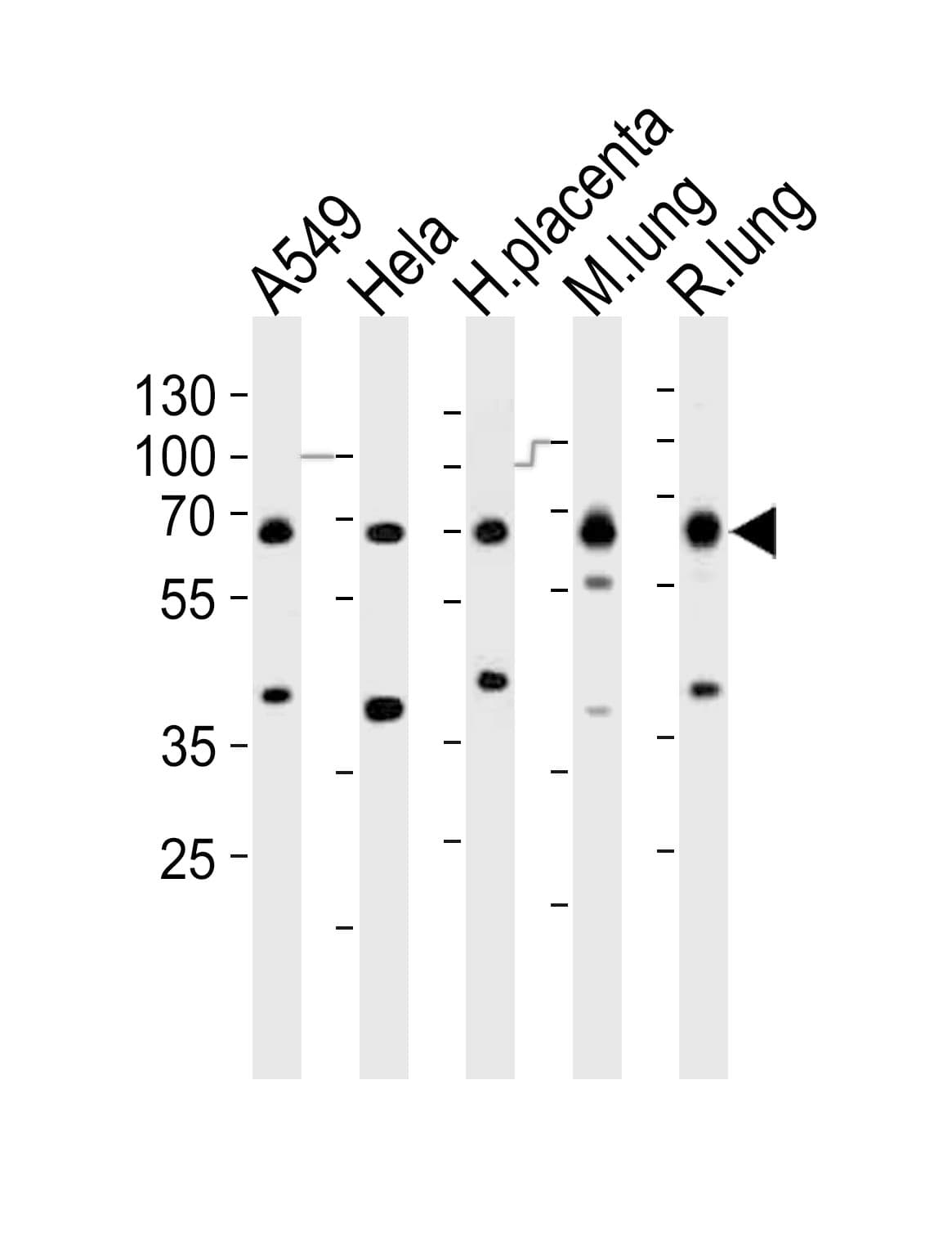 Polyclonal Rabbit anti-Human EHD2 Antibody (aa415-449, IHC, WB)