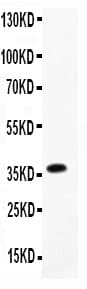 Polyclonal Rabbit anti-Human MPO / Myeloperoxidase Antibody (IHC, WB)