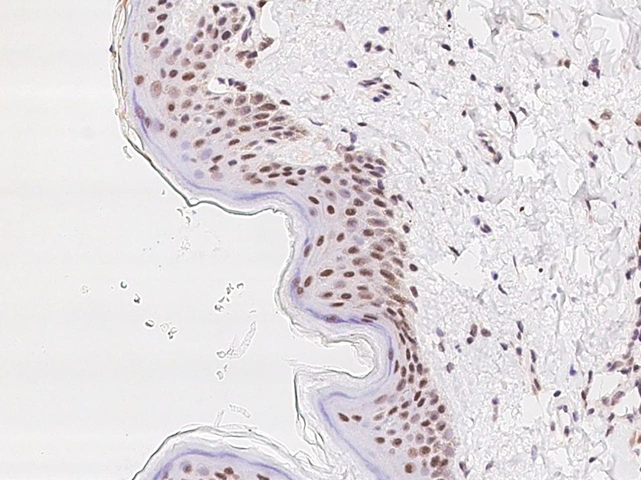 SUPT16H / FACTP140 Antibody