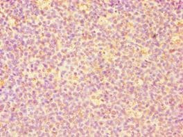 Polyclonal Rabbit anti-Human CASP6 / Caspase 6 Antibody (aa24-293, IHC, WB)