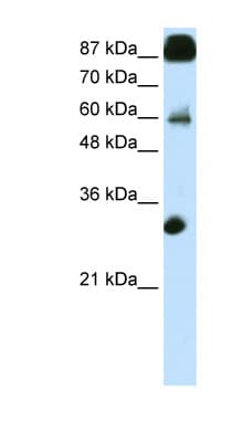 Polyclonal Rabbit anti-Human CTCF Antibody (N-Terminus, IHC, WB)