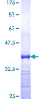 Human Peripherin Protein (Recombinant GST, N-terminus)