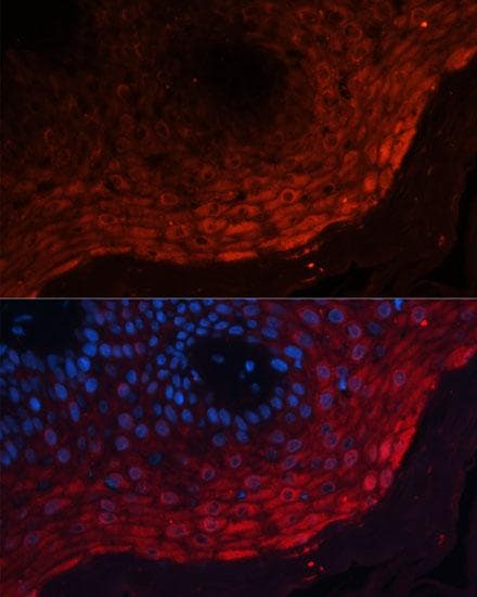 S100A8 / MRP8 Antibody