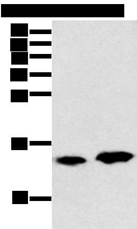 CARTPT / CART Antibody