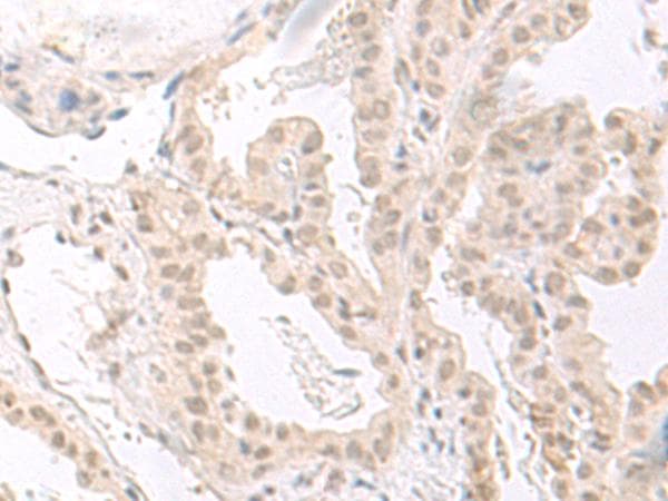 Polyclonal Rabbit anti-Human HOOK2 Antibody (IHC)