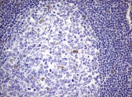 ZEB2 / SIP-1 Antibody (aa1-350, clone OTI1E12)