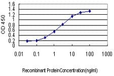 PAFAH1B1 / LIS1 Antibody (clone 2C12)