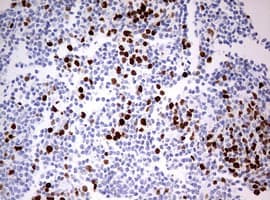 TOP2A / Topoisomerase II Alpha Antibody (aa1100-1531, clone 1D2, Carrier-free)