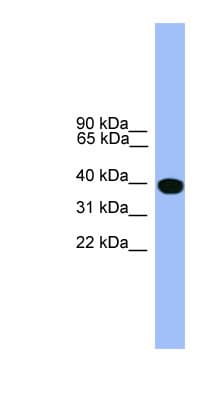SERPINA1 / Alpha 1 Antitrypsin Antibody (aa291-340)