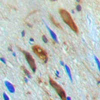 SMAD3 Antibody (phospho-Thr179)