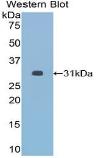 HDAC6 Antibody (aa560-811)