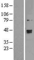 TRMT2B Protein (Over-Expression Lysate Myc-DDK (Flag))