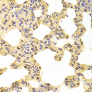 MAP2K1 / MKK1 / MEK1 Antibody