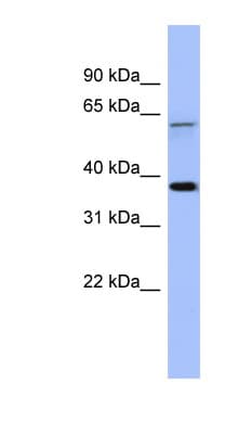 MAGEB1 Antibody (aa251-300)