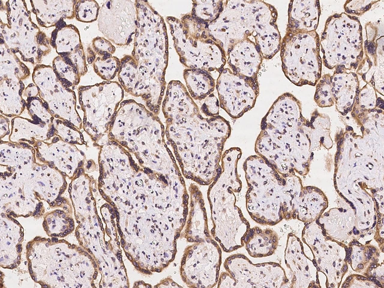 Polyclonal Rabbit anti-Human GP78 / AMFR Antibody (IHC)