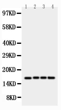 Polyclonal Rabbit anti-Human BIRC5 / Survivin Antibody (aa121-142, WB)