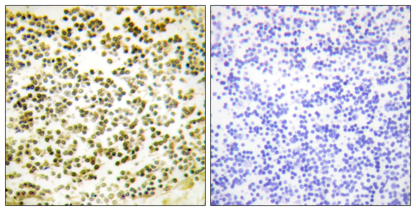 RBL1 / p107 Antibody (phospho-Thr369)