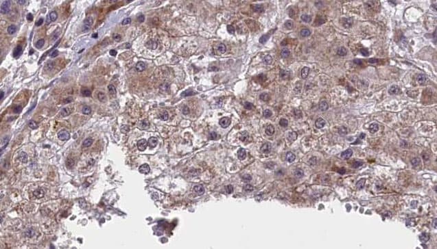 Neurofascin / NF Antibody