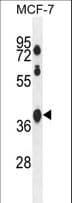 SPATA2L Antibody (aa206-235)