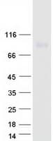Human ITFG1 / TIP Protein (Recombinant Myc-DDK (Flag))