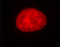 IHC-plus™ HDAC4 Antibody (N-Terminus)