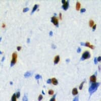 LUC7L2 Antibody (Internal)