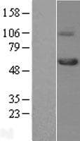 Human TGFBR1 / ALK5 Protein (Over-Expression Lysate Myc-DDK (Flag))