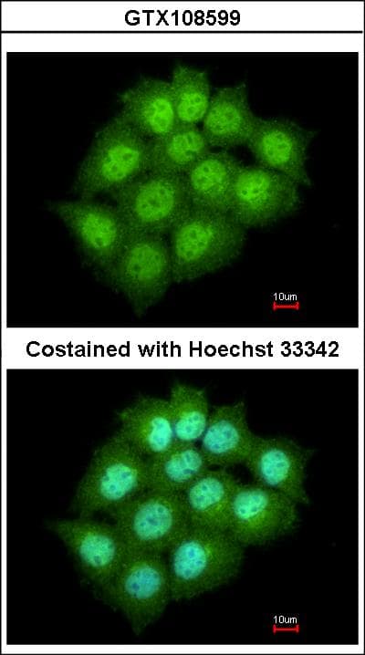Polyclonal Rabbit anti-Human ARL14 Antibody (aa1-192, IHC, WB)