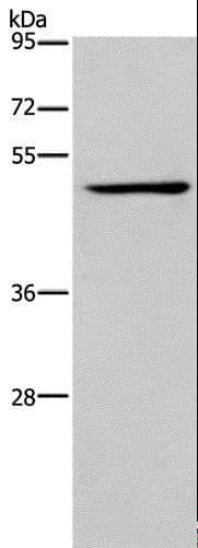 IRF4 Antibody